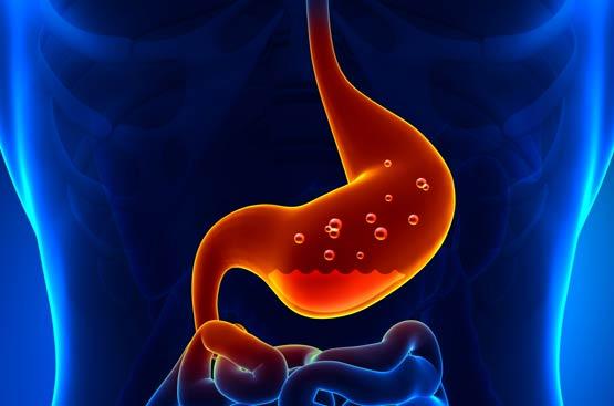 Understanding Gastroesophageal Reflux Disease (GORD)